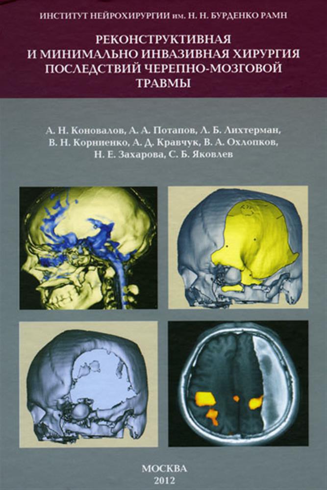 Нейрохирургия коновалов. Нейрохирургия книга. Мозг нейрохирургия книга. Нейрохирургия обложки. Нейрохирургия книги для врачей.